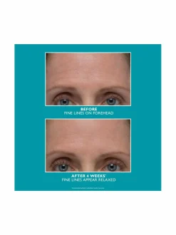 Kasvojenhoito<Peter Thomas Roth Peptide Skinjection Amplified Wrinkle-Fix Serum -seerumi
