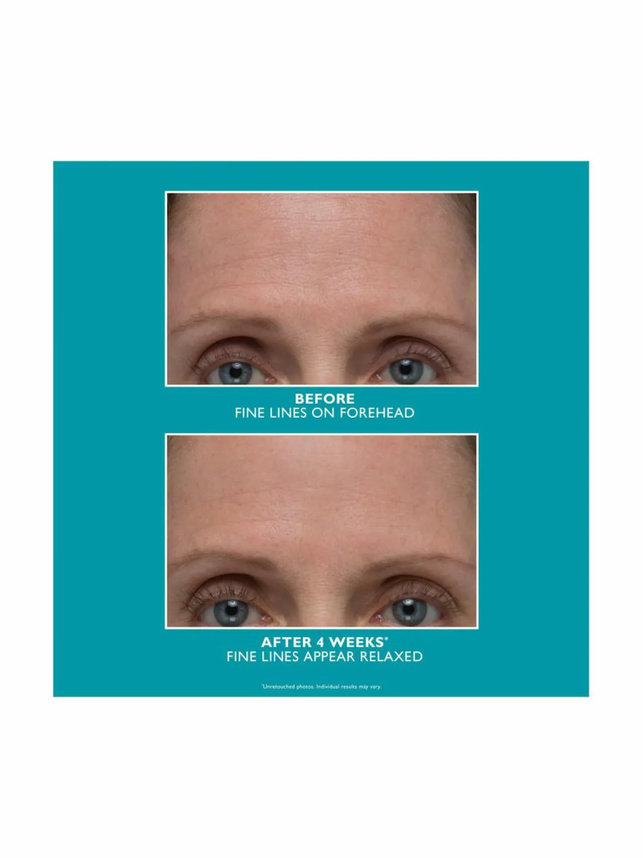 Kasvojenhoito<Peter Thomas Roth Peptide Skinjection Amplified Wrinkle-Fix Serum -seerumi