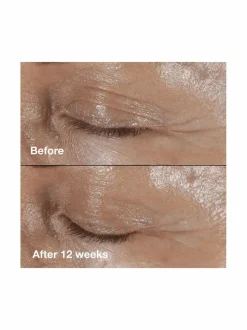 Kasvojenhoito<Clinique Smart Clinicial Repair Wrinkle Correcting Eye Cream -silmänympärysvoide 15 ml