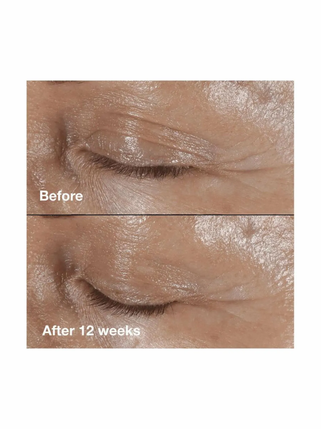 Kasvojenhoito<Clinique Smart Clinicial Repair Wrinkle Correcting Eye Cream -silmänympärysvoide 15 ml