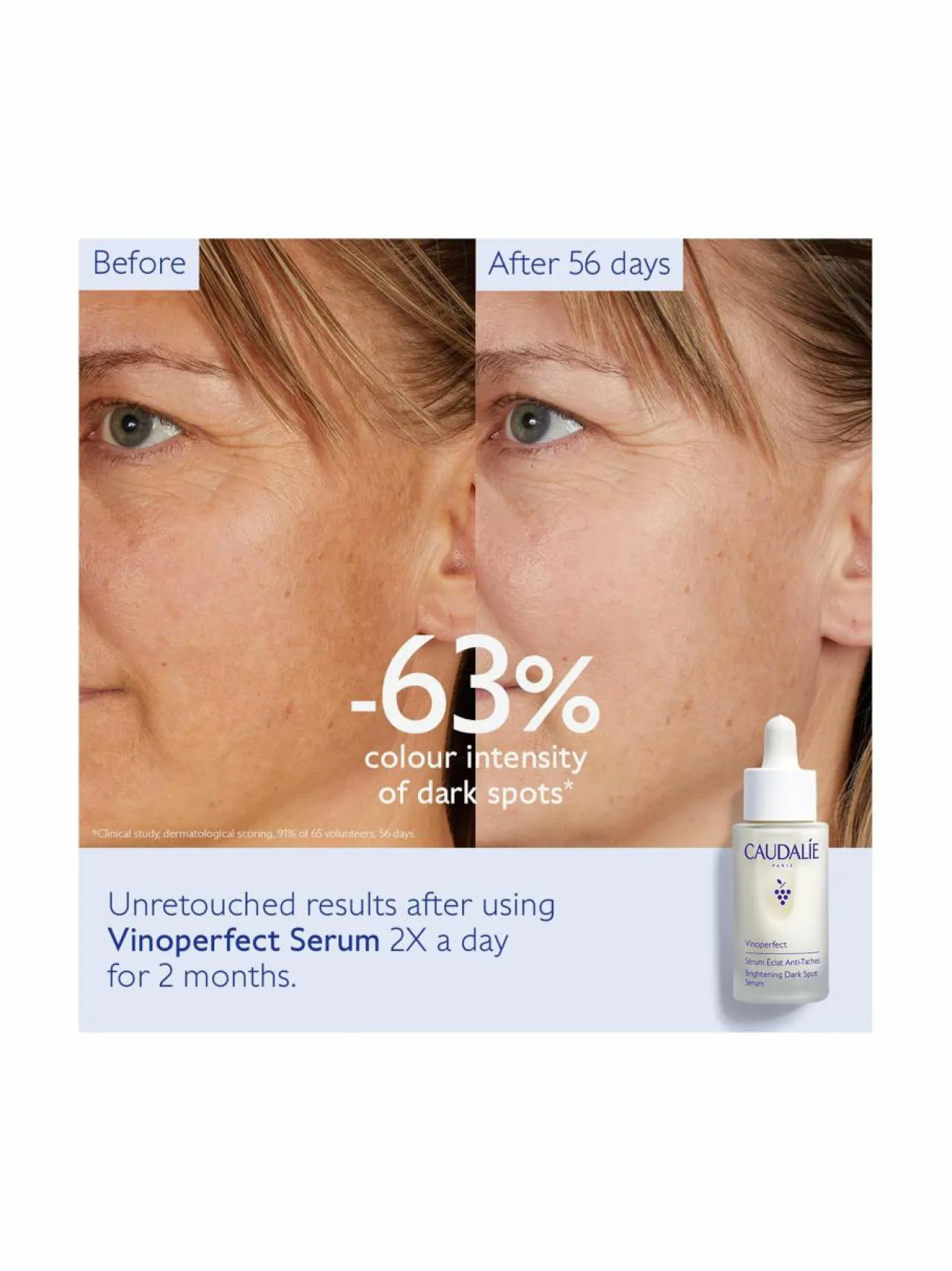 Kasvojenhoito<Caudalie Vinoperfect Brightening Dark Spot Serum -seerumi